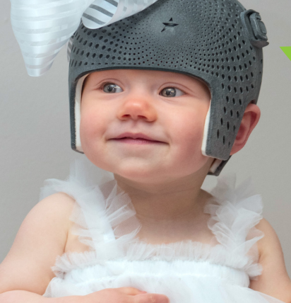 Keeping Your Baby Cozy in a Cranial Helmet