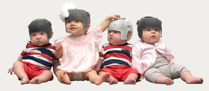 What To Expect During Cranial Helmet Therapy