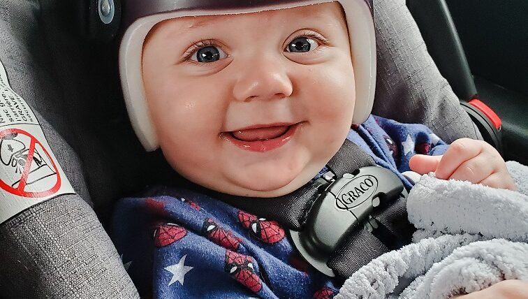 Traveling with an Infant in a Cranial Helmet