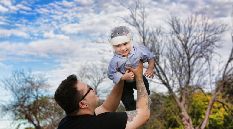 Adapting to Life with a Cranial Helmet: Strategies for Families
